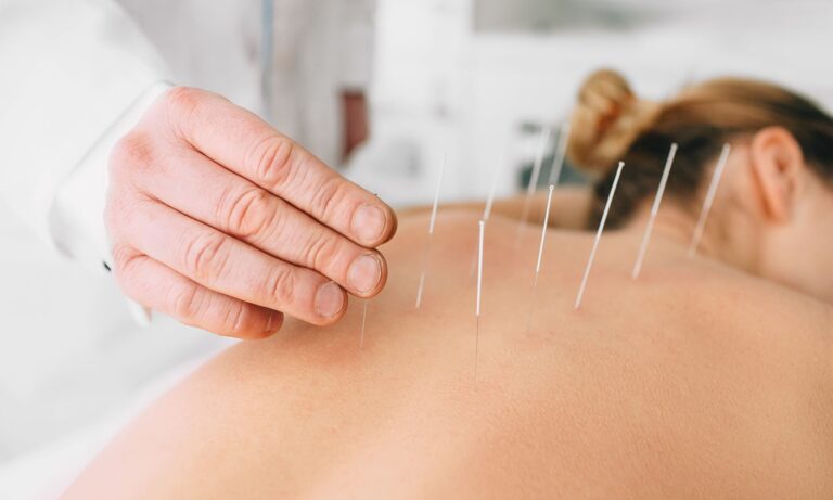 acupuncture services at Women's Health Physiotherapy